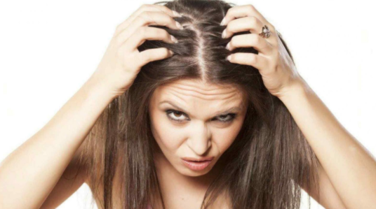 alopecia en mujeres